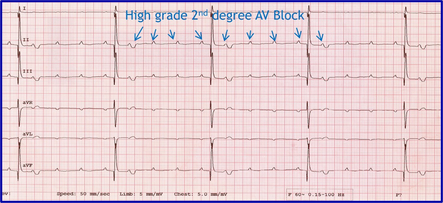 เปิด 5 สถิติน่ารู้ “หัวใจเต้นผิดจังหวะในหมา” เงียบแต่แรง ถ้ารู้ทันก็เซฟชีวิตได้ (อัปเดท 2025)